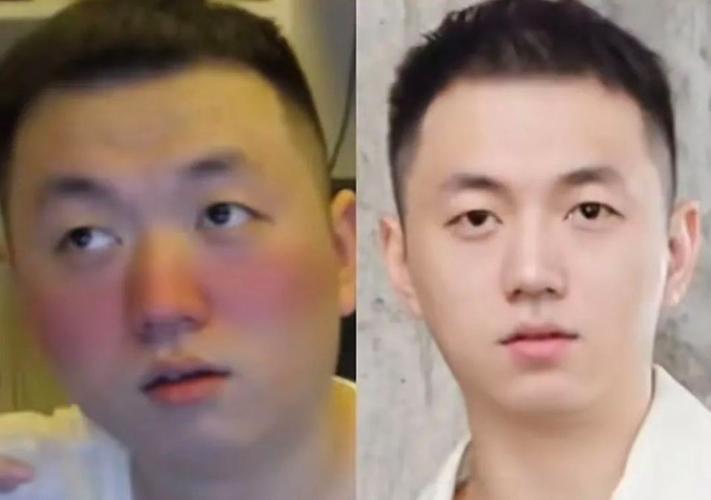药水哥怎么了[图1]